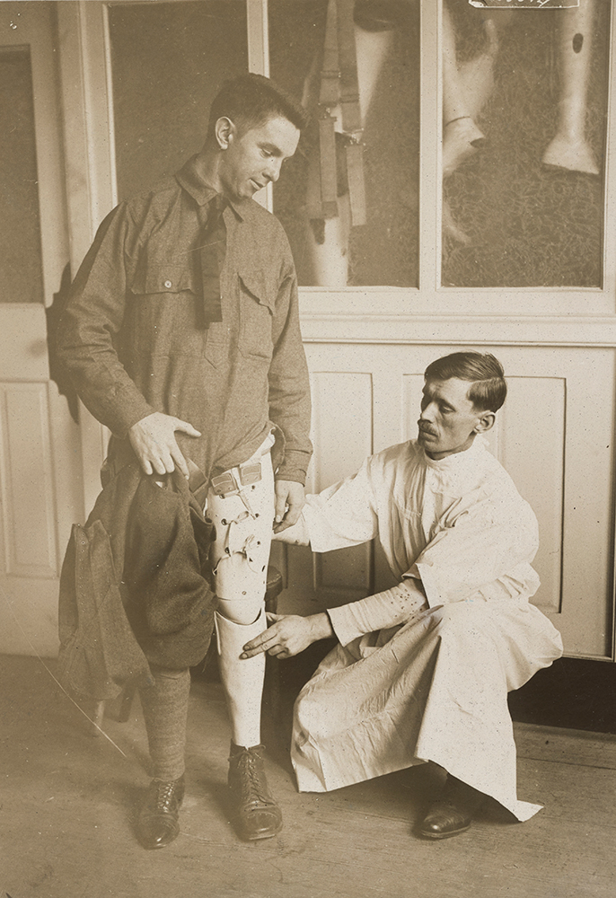 Sepia photo of two men. One man is in military uniform, standing up, with his left pants leg pulled up or removed to show that his left leg is artificial. The second man is kneeling, dressed in medical uniform, making adjustments to the first man's artificial leg.