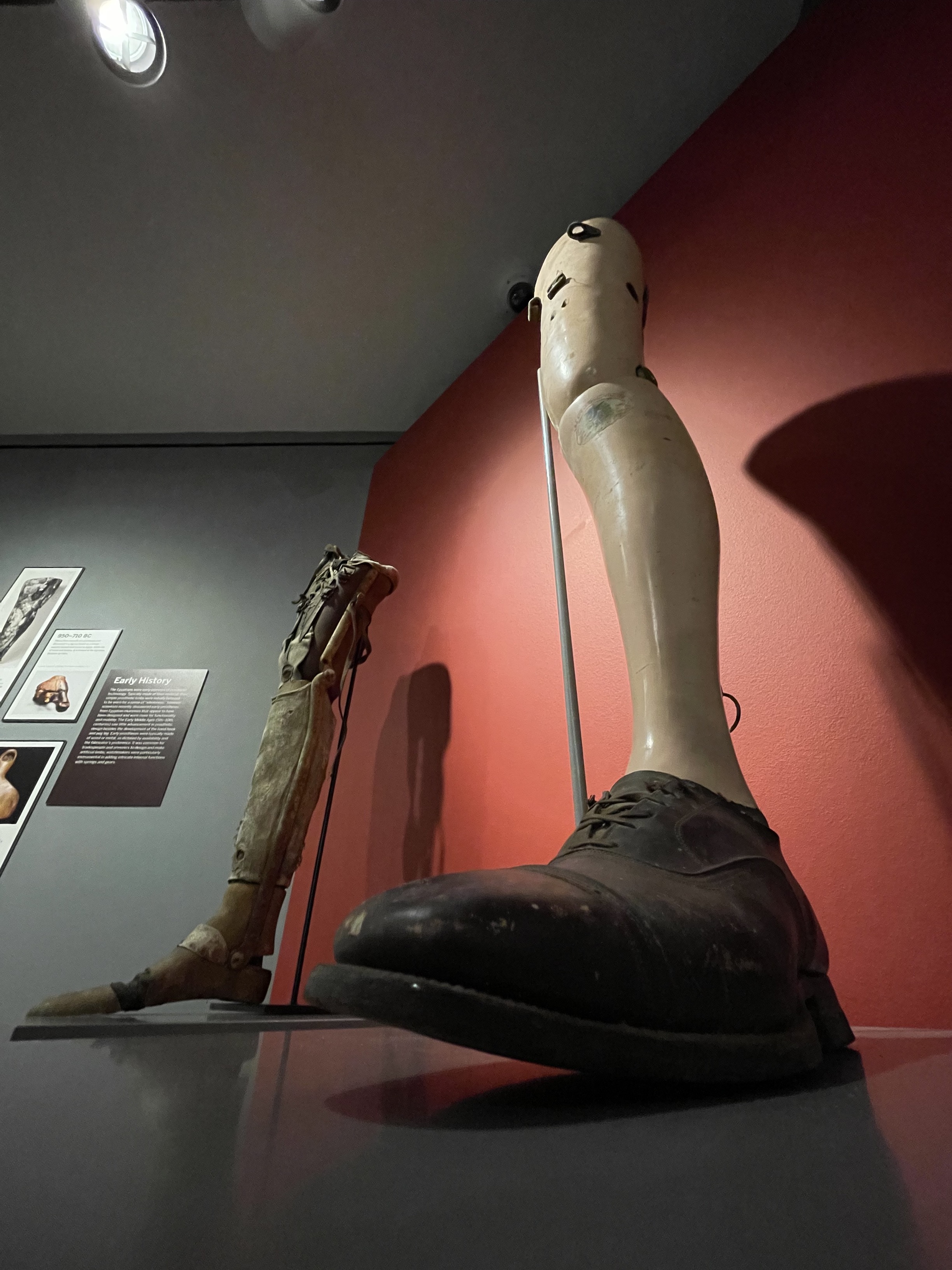Modern photograph of a prosthetic foot and leg going up to the upper thigh or hip. The foot is wearing a brown leather shoe.