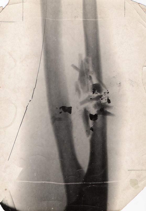 Marie Curie involved in the war effort